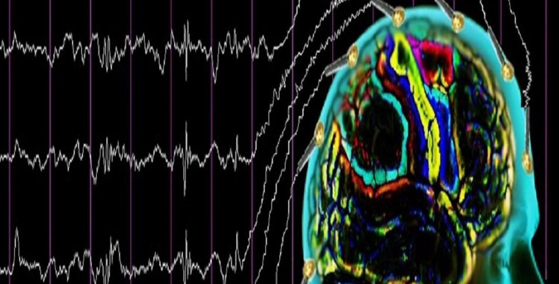 Sara-Hastaligi-ve-Epilepsi-Nobeti-icin-Manevi-Dua-Tedavisi